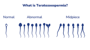 What is Teratozoospermia? A Detailed Guide to Understanding Causes and Symptoms